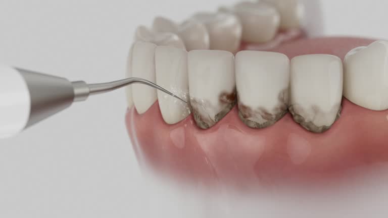 Trusted Tooth Extraction service in Grill, PA - Dentist Open Now